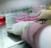 המרכז לבקרת המחלות האמריקאי קושר התפרצות סלמונלה לעבודת מעבדה