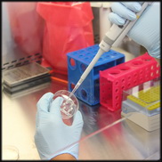 סלמונלה: דו"ח המעבדות המרכזיות של משרד הבריאות - 2018