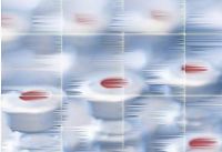 המאבק על נגיפי שפעת העופות