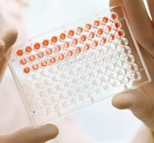 התאמה בין בידודי נגיף שפעת העופות