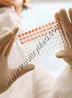 נוגדנים לנגיף שפעת עופות H5 בעופות בפינת חי בקיבוץ אורים