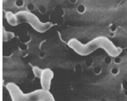 קמפילובקטר בעופות: כתבה בעיתון הארץ